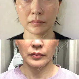 東京形成美容外科 船橋院口コミ