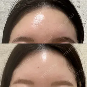 美容皮膚科エルムクリニック 大阪院口コミ