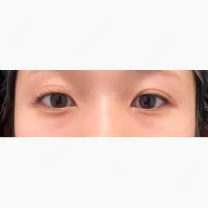 X CLINIC 大阪院口コミ