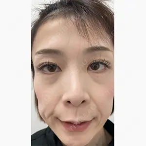 TCB東京中央美容外科 神戸院口コミ