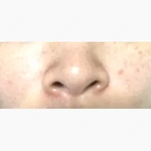 東京形成美容外科 銀座院口コミ