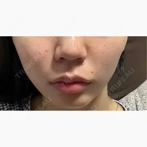 美容皮膚科エルムクリニック 大阪院口コミ