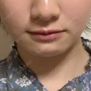 キップン整形外科口コミ