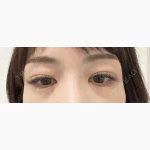 TCB東京中央美容外科 神戸院口コミ