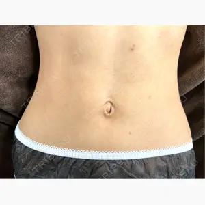 藤・ナチュレ美容クリニック 銀座院口コミ