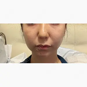 BON BON CLINIC 銀座駅前本院口コミ