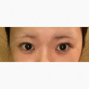 HANABI整形外科口コミ