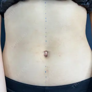 藤・ナチュレ美容クリニック 銀座院口コミ