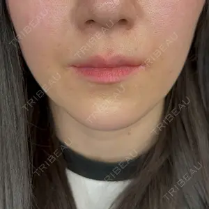 ウィルビークリニック 新宿院口コミ