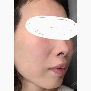 LOCHIC CLINIC GINZA【ロシッククリニック銀座】口コミ