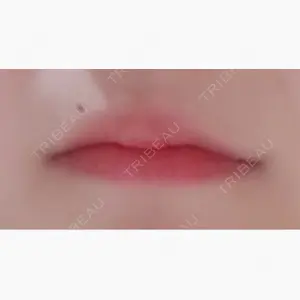 R Beauty CLINIC 銀座院口コミ