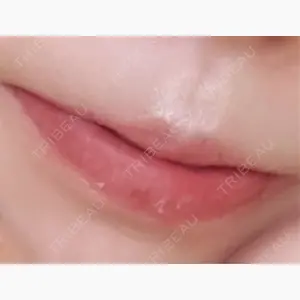 R Beauty CLINIC 銀座院口コミ