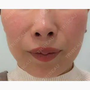 Chloe Cheongdam Clinic （クロエチョンダムクリニック）口コミ