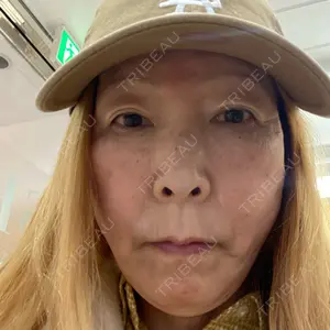 湘南美容クリニック 西葛西院口コミ