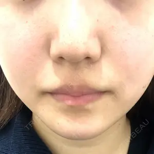 ジョウクリニック 大阪院口コミ