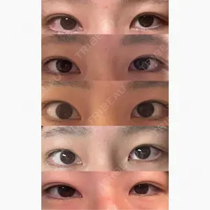プロミス整形外科口コミ