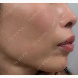 東京シルククリニック 新宿院口コミ