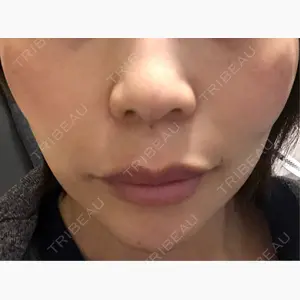 BON BON CLINIC 銀座駅前本院口コミ