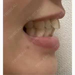 SF六本木東京 dental orthodontics口コミ