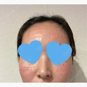 シェリークリニック 福岡院口コミ
