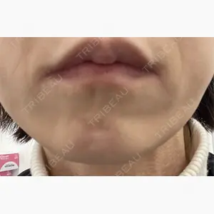 TCB東京中央美容外科 神戸院口コミ