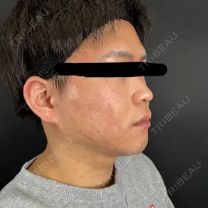 藤・ナチュレ美容クリニック 銀座院口コミ