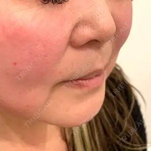 東京素肌クリニック 銀座本院口コミ