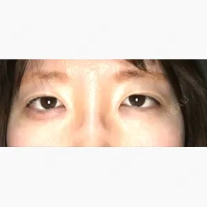 MIYAフェイスクリニック口コミ