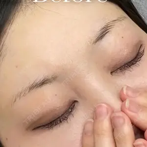 APスキンクリニック銀座口コミ