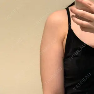 脂肪吸引ラボトウキョウ口コミ