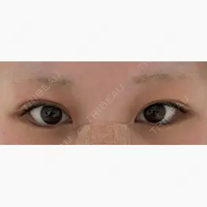 BELINDA CLINIC（ベリンダクリニック）新宿院口コミ