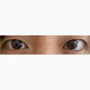 オアシス美容外科口コミ