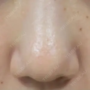 千里中央花ふさ皮ふ科口コミ