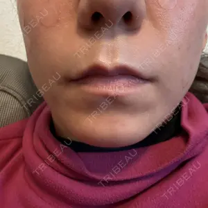 エースクリニック 大阪梅田HEPナビオ院口コミ