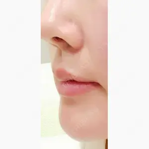 共立美容外科 梅田院口コミ