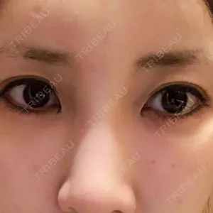 ボナイ整形外科口コミ