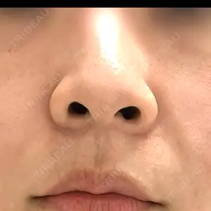 東京シンデレラ美容外科 池袋院口コミ