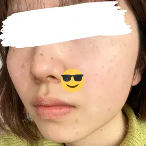 きれいクリニック口コミ