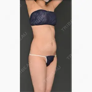 Lipo Clinic omotesando口コミ