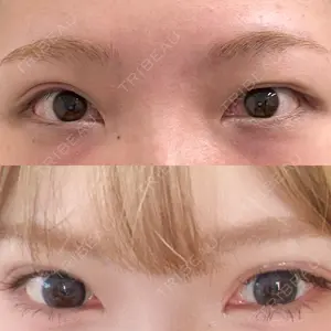 湘南美容クリニック 西葛西院口コミ