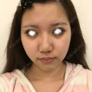View美容整形外科口コミ
