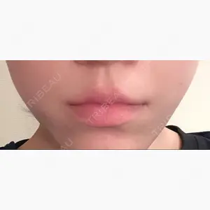 ボナイ整形外科口コミ