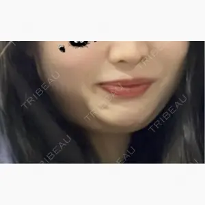 ミケイ医院口コミ