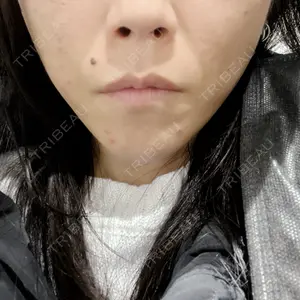 TCB東京中央美容外科 なんば院口コミ