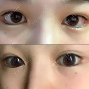 ジュエリー美容外科口コミ
