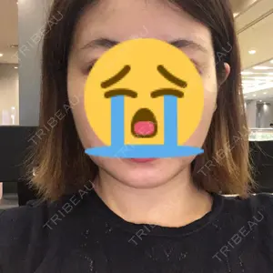 FI整形外科口コミ