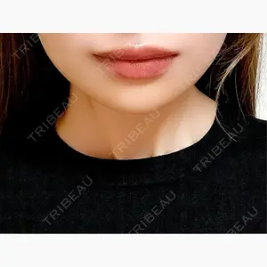 TCB東京中央美容外科 長野院口コミ