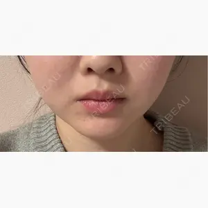 TCB東京中央美容外科 町田院口コミ