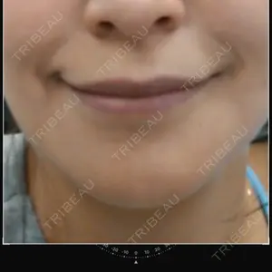 id（アイディ）美容外科口コミ