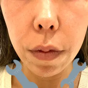 HAAB×DREAM BEAUTY CLINIC 大阪梅田院口コミ